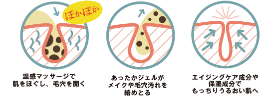 킟[肠WF